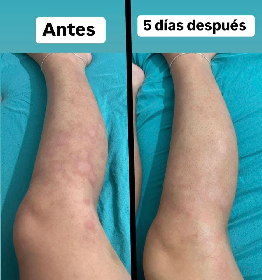Testimonios