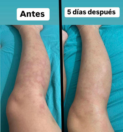 Testimonios