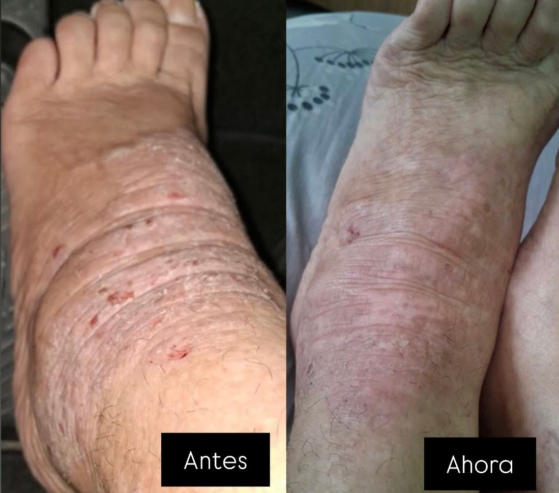 Testimonios