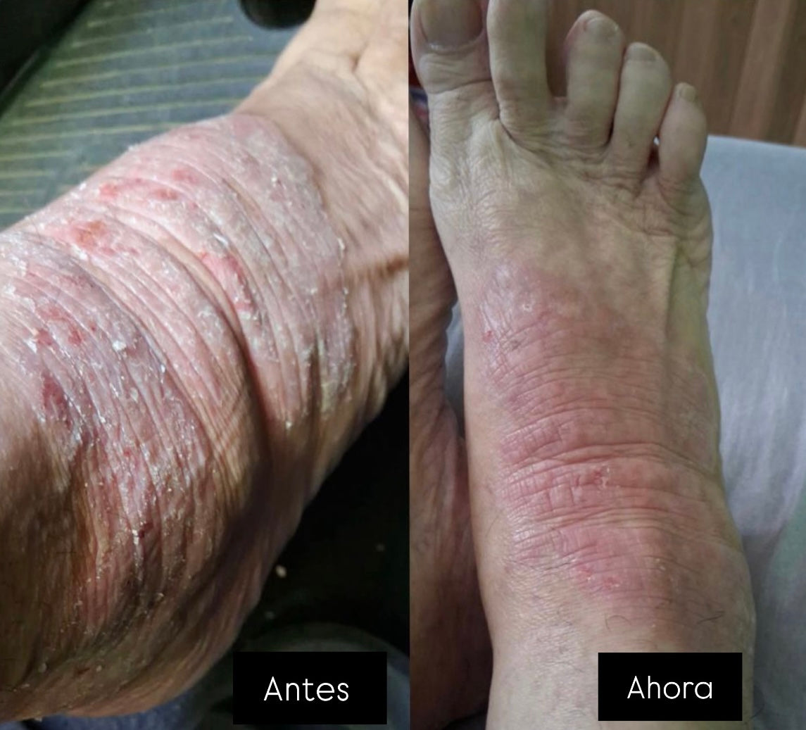 Testimonios