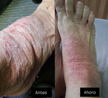 Testimonios
