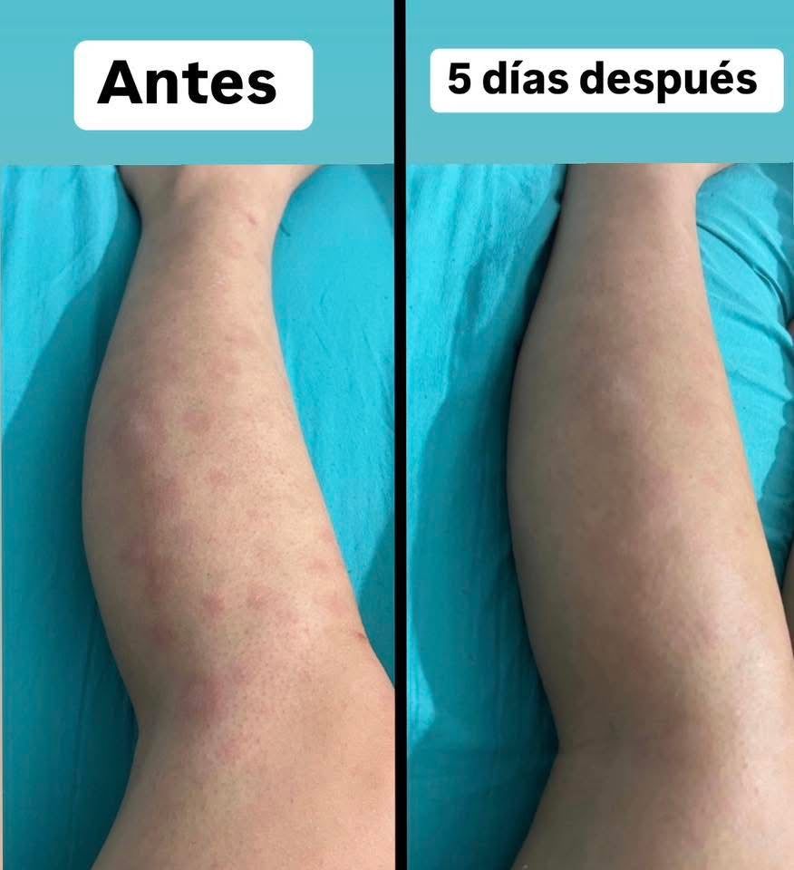 Testimonios