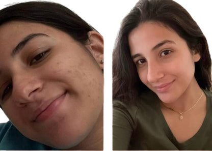 Testimonios
